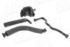 Комплект вентиляції картера BMW 3 (E46)/X3 (E83) 1.6i/2.0i 00-11 (M42/M46) AIC 56965Set (фото 1)