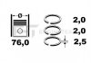 Набор поршневых колец ET ENGINETEAM R1004400 (фото 2)