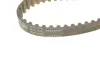 Комплект ГРМ Citroen C5 III/C6/Peugeot 407 2.7D/3.0D 04- HEPU 20-1638 (фото 7)