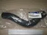 Патрубок радіатора Hyundai/Kia/Mobis 254111J100 (фото 2)