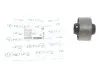 Сайлентблок важеля (переднього/спереду) Hyundai Tucson/Accent/Kia Sportage 04- MEYLE 37-14 610 0006 37-14 610 0006